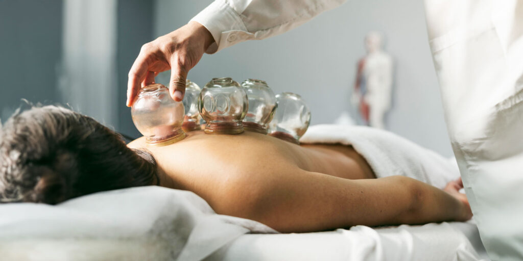 fire cupping wet cupping hijama