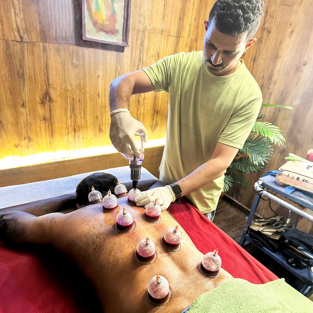 Hijama-therapy