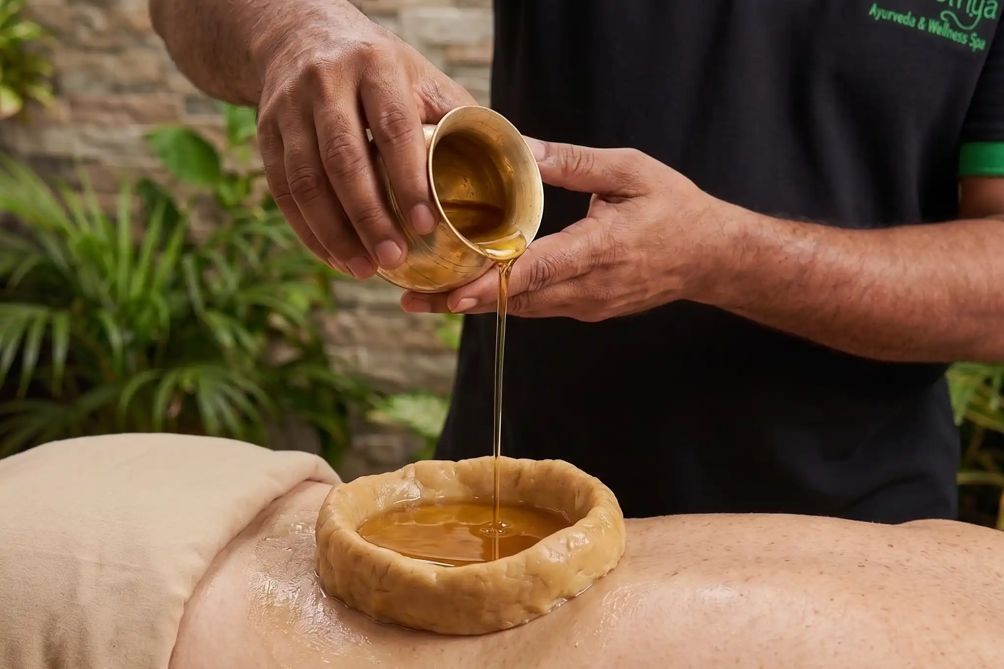 Kati Vasti for back pain at Swasthya Ayurveda, Kannur